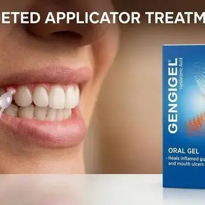 Gengigel Oral Gel