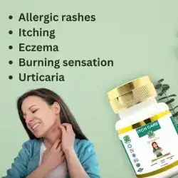 Tablet for body itching , allergy