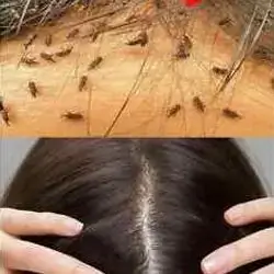 Anti lice shampoo