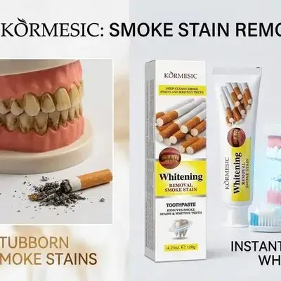 KÖRMESIC Whitening Removal Smoke Stain Toothpaste - 120g