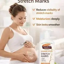 massage body  lotion stretch marks