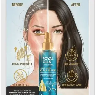 Head & Shoulders Royal Oils Scalp Elixir Treatment, Formulated with Cooling Menthol and Peppermint Oil for Instant Scalp Soothe and Hydration, 4.2 fl oz