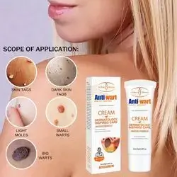 anti wart cream