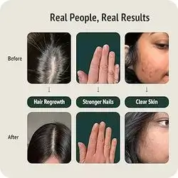 Skin Hair Nail Vitamins