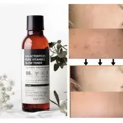 Some By Mi Galactomyces Pure Vitamin C Glow Toner