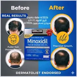 Kirkland Signature Minoxidil 5% Topical Solution for Men - 6 Month Supply (6 x 2 Fl Oz), Hair Regrowth Treatment with Dropper, Beard growth