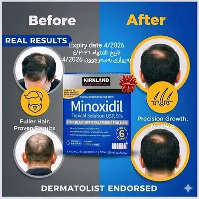 Kirkland Signature Minoxidil 5% Topical Solution for Men - 6 Month Supply (6 x 2 Fl Oz), Hair Regrowth Treatment with Dropper, Beard growth