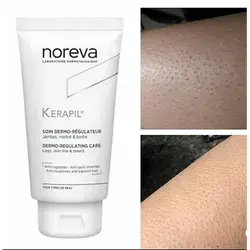 Noreva Kerapil Cream