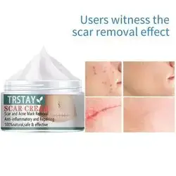 TRSTAY Scar Cream, Scar and Acne Mark Removal