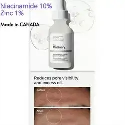 The Ordinary Niacinamide 10% + Zinc 1%, Smoothing Serum for Blemish-Prone Skin, the ordinary, HYDRATING FORMULA, boost brightness and smoothness