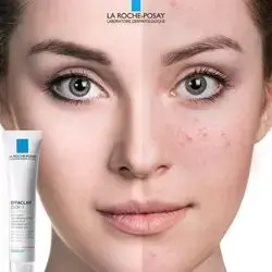 Acne Cream