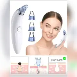 Blackhead Vacuum Remover, Powerful Portable Facial Pore Cleaner With 4 Suction Heads