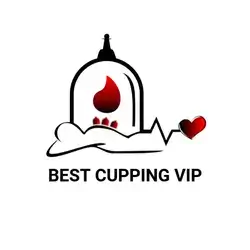 Cupping (Hijama)