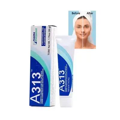 A313 Light Vitamin A (Retinoids) Face Cream Anti Aging Reduce Wrinkles Prevent Acne Breakouts & Hyperpigmentation - Skin Care for Smooth & Radiant Skin - 50g Cream