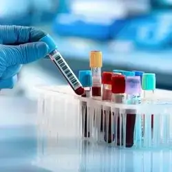 HBA1C