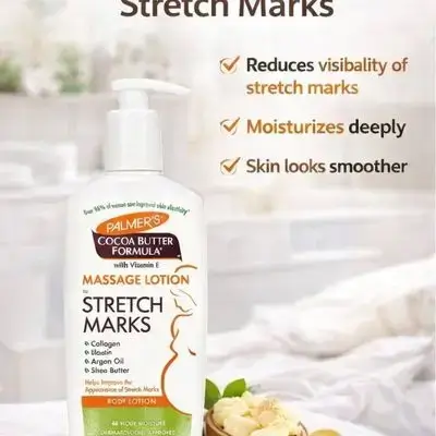 massage body lotion stretch marks