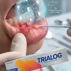 TRIALOG Dental Paste
