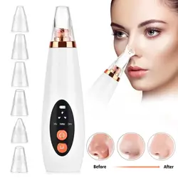 Moehair Vacuum+ 6 in 1 Pro Extreme Device