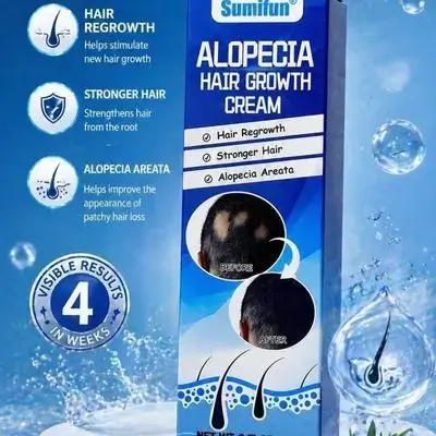 Sumifun Alopecia Hair Growth Cream