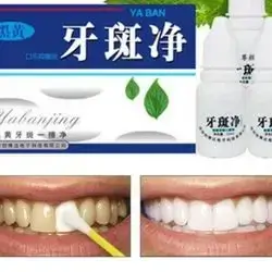 Tooth Whitenig