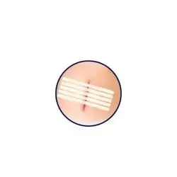 Wound Closure Adhesive Strips (0.6x10cm) (30pcs)