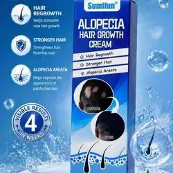 Sumifun Alopecia Hair Growth Cream