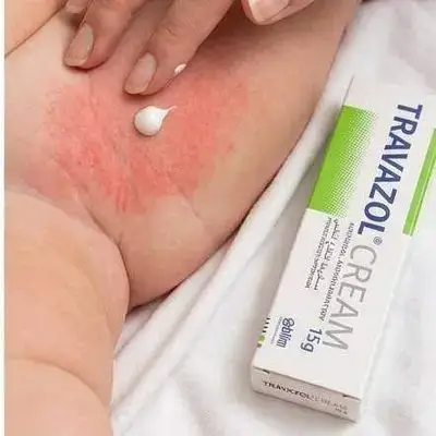 TRAVAZOL CREAM (15g)