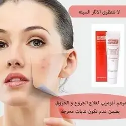 avomeb ointment mebo 