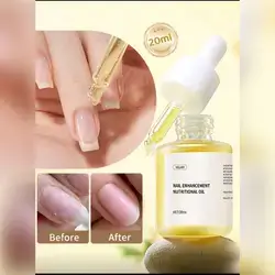 XEIJAYI 20ml Nail Nutrition Cuticle Care Oil - Yellow