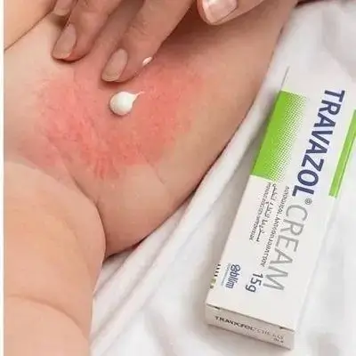 TRAVAZOL CREAM (15g)