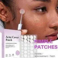 108 piece Acne Treatment Patches Salicylic Acid & Tea Oil Gentle Blemish Care