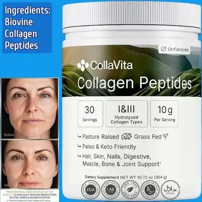 Collagen Peptides Powder, Grass-Fed Pasture-Raised Hydrolyzed Collagen, Collagen Peptides, Type I & III Hair, Nails, Skin and Joints, Paleo & Keto, HALAL, Unflavored, 30 Servings, 304g collagen