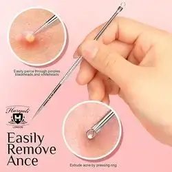 Stainless Blackhead Remover Tool Acne Blemish Needle Pimple Spot 